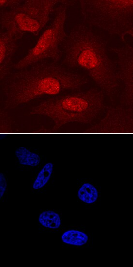Carm1 antibody in HeLa Human Cell Line by Immunocytochemistry (ICC).