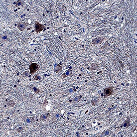Casein Kinase 1? antibody in Human Brain by Immunohistochemistry (IHC-P).