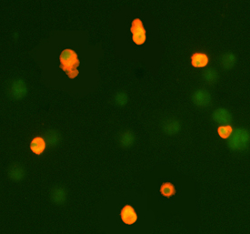 Caspase‑3 antibody in Jurkat Human Cell Line by Immunocytochemistry (ICC).