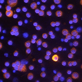 Caspase-11/Caspase-4 antibody in Mouse Splenocytes by Immunocytochemistry (ICC).