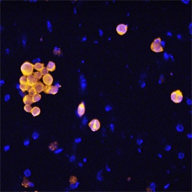 Caspase-8 antibody in Jurkat Human Cell Line by Immunocytochemistry (ICC).