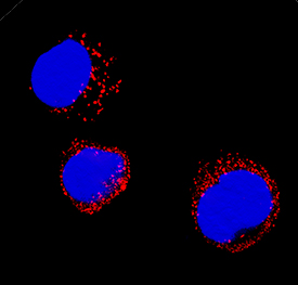 Catalase antibody in HL-60 Human Cell Line by Immunocytochemistry (ICC).