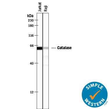 Detection of Human Catalase antibody by Simple WesternTM.