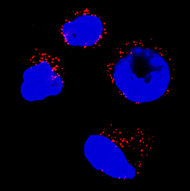 Catalase antibody in HL-60 Human Cell Line by Immunocytochemistry (ICC).