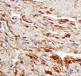 Cathepsin F antibody in Human Heart by Immunohistochemistry (IHC-P).