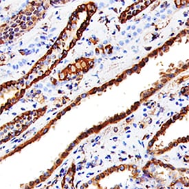 Cathepsin L antibody in Human Kidney by Immunohistochemistry (IHC-P).