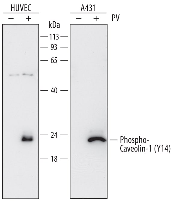 Detection of Human Phospho-Caveolin-1 (Y14) antibody by Western Blot.