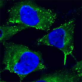 Caveolin-1 antibody in HeLa Human Cell Line by Immunocytochemistry (ICC).