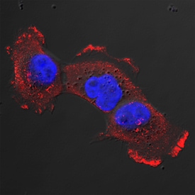 Caveolin-1 antibody in A431 Human Cell Line by Immunocytochemistry (ICC).
