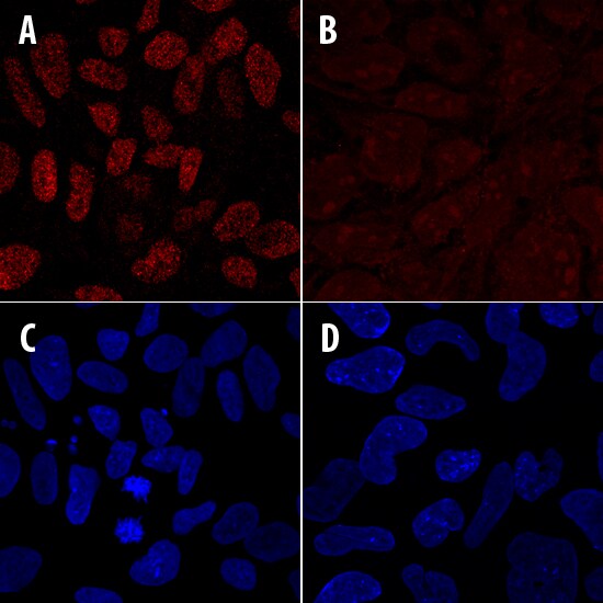 Cbx2 antibody in iPS2 Human Stem Cells by Immunocytochemistry (ICC).