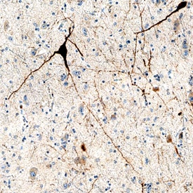 Cerebellin-4 antibody in Human Hypothalamus by Immunohistochemistry (IHC-P).