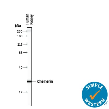 Detection of Human Chemerin antibody by Simple WesternTM.