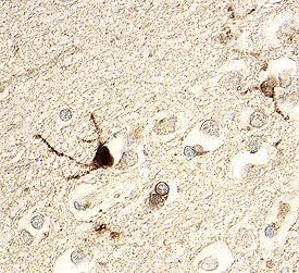 Choline Acetyltransferase/ChAT antibody in Human Brain by Immunohistochemistry (IHC-P).