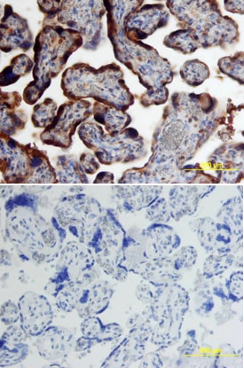 Chorionic Gonadotropin, a Chain (a HCG) antibody in Human Placenta by Immunohistochemistry (IHC-P).