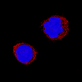 Chromogranin A antibody in H69AR Human Cell Line by Immunocytochemistry (ICC).