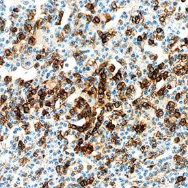 Chromogranin A antibody in Human Parathyroid by Immunohistochemistry (IHC-P).