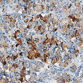 Chromogranin B antibody in Human Pituitary Gland by Immunohistochemistry (IHC-P).