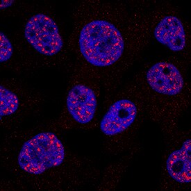 Cited-2 antibody in HeLa Human Cell Line by Immunocytochemistry (ICC).
