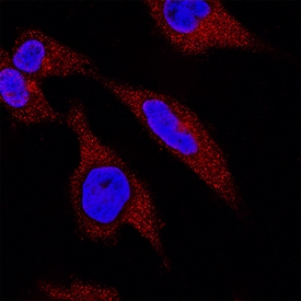 Claspin antibody in HeLa Human Cell Line by Immunocytochemistry (ICC).