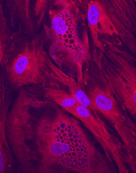 Clathrin Heavy Chain 2/CHC22 antibody in Human Mesenchymal Stem Cells by Immunocytochemistry (ICC).