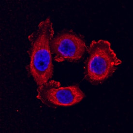 Claudin-3 antibody in PC-3 Human Cell Line by Immunocytochemistry (ICC).