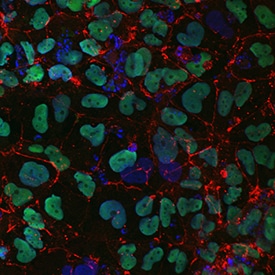 Claudin-6 antibody in iPS2 Human Induced Pluripotent Stem Cells by Immunocytochemistry (ICC).