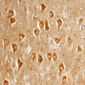 Clusterin antibody in Human Brain by Immunohistochemistry (IHC-P).