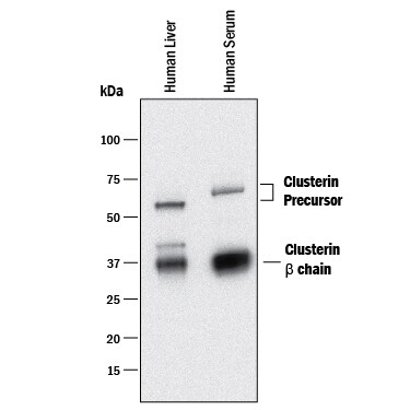 Detection of Human Clusterin  beta  chain antibody by Western Blot.