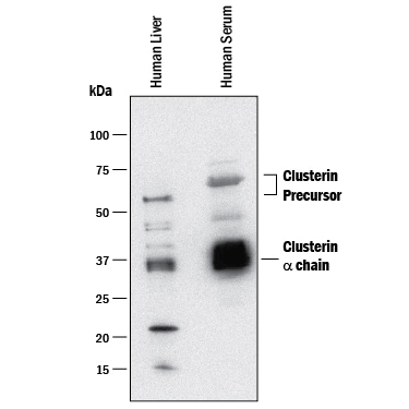 Detection of Human Clusterin antibody by Western Blot.