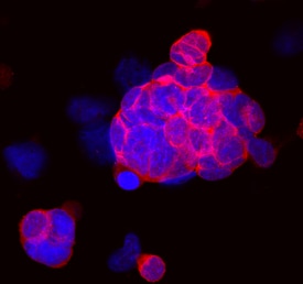 Coactosin-like Protein 1/COTL1 antibody in NCI-H128 Human Cell Line by Immunocytochemistry (ICC).