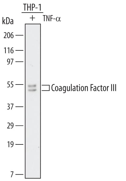 Detection of Human Coagulation Factor III antibody by Western Blot.