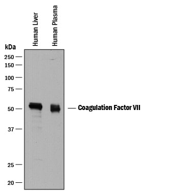 Detection of Human Coagulation Factor VII antibody by Western Blot.