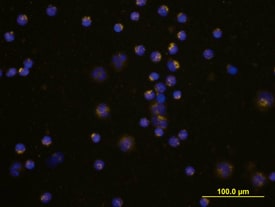 Coagulation Factor VII antibody in Human PBMCs by Immunocytochemistry (ICC).