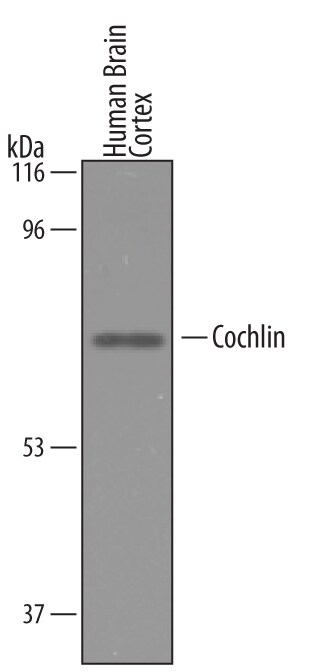 Detection of Human Cochlin antibody by Western Blot.
