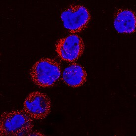 Collagen IV a1 antibody in THP-1 Human Cell Line by Immunocytochemistry (ICC).