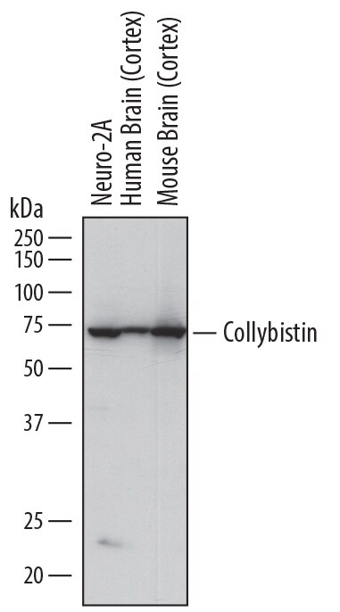 Detection of Human and Mouse Collybistin/ARHGEF9 antibody by Western Blot.