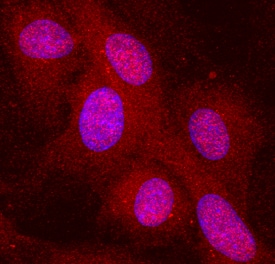 Complement Component C1qC antibody in Human HUVEC by Immunocytochemistry (ICC).