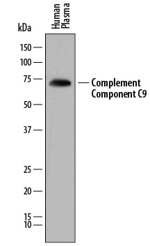 Detection of Human Complement Component C9 antibody by Western Blot.