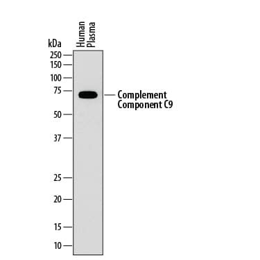 Detection of Human Complement Component C9 antibody by Western Blot.