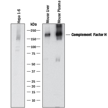 Detection of Mouse Complement Factor H antibody by Western Blot.