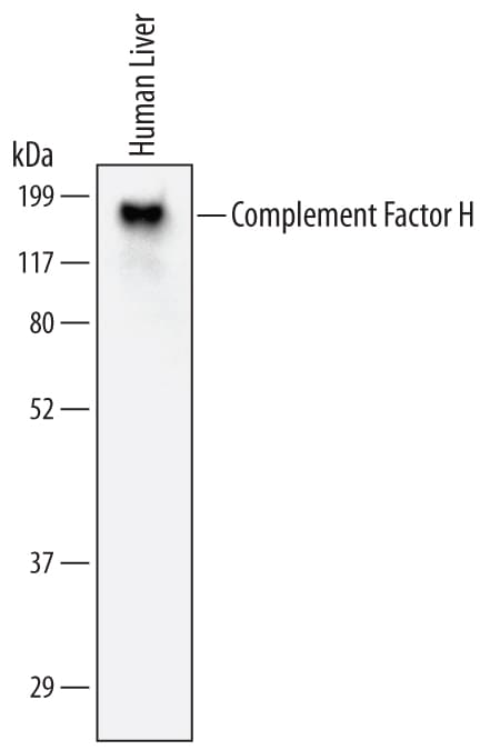 Detection of Human Complement Factor H antibody by Western Blot.