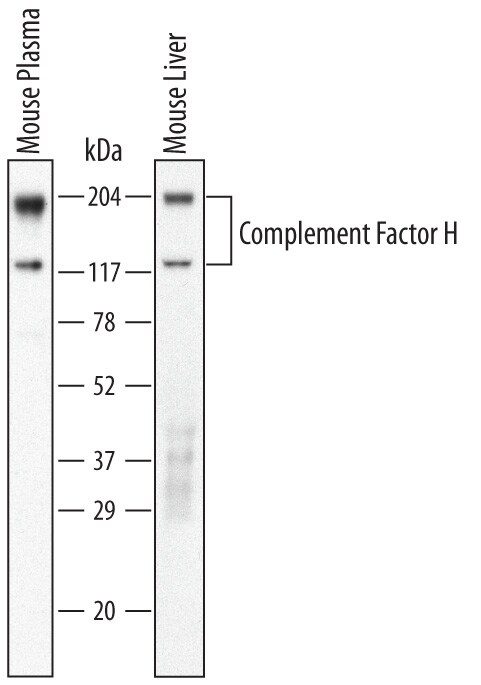 Detection of Mouse Complement Factor H antibody by Western Blot.