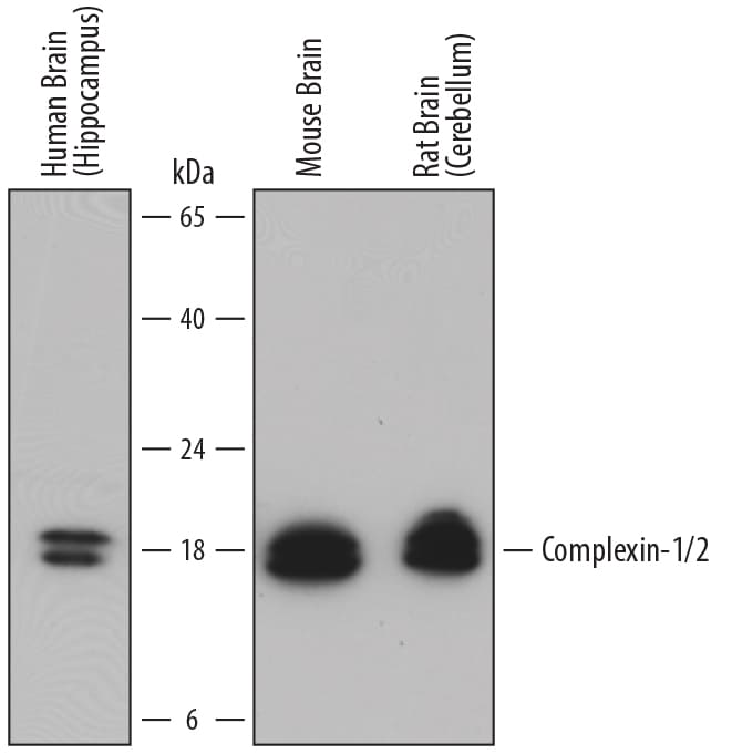 Detection of Human, Mouse, and Rat Complexin-1/2 antibody by Western Blot.