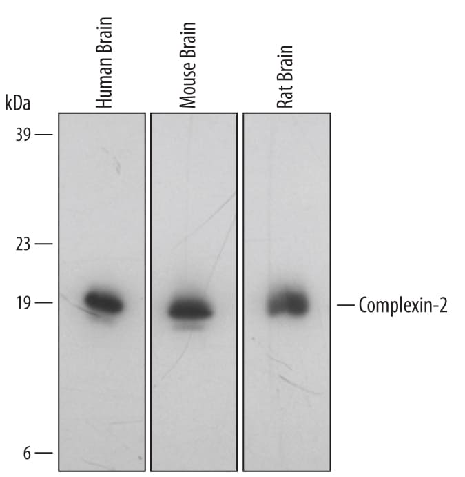 Detection of Human/Mouse/Rat Complexin-2 antibody by Western Blot.
