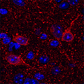 Complexin-1/2 antibody in Mouse Brain.