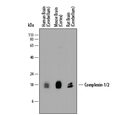Detection of Human, Mouse, and Rat Complexin-1/2 antibody by Western Blot.