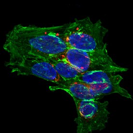 Complexin-2 antibody in SH-SY5Y Human Neuroblastoma Cells by Immunocytochemistry (ICC).