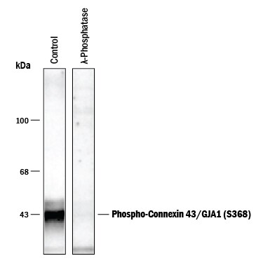 Detection of Phospho-Connexin 43/GJA1 (S368) antibody by Western Blot.