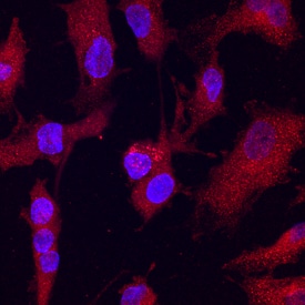 Crossveinless-2/CV-2 antibody in HUVEC Human Cells by Immunocytochemistry (ICC).