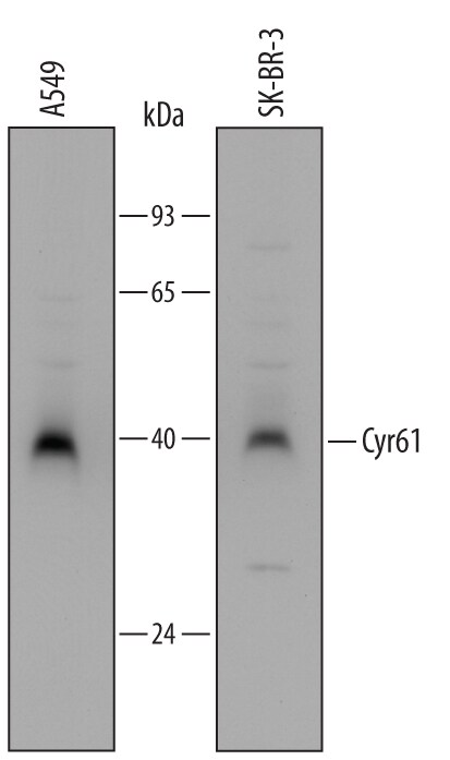 Detection of Human Cyr61/CCN1 antibody by Western Blot.